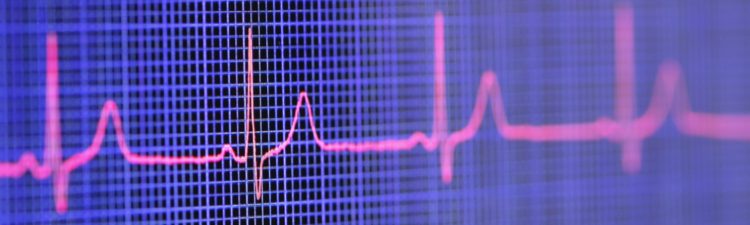 Electrocardiogram-Electrocardiogram displayed on the screen of a tablet computer.